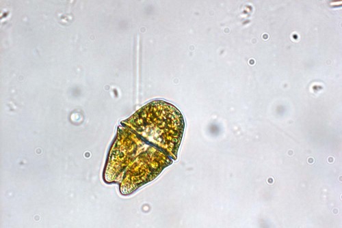 A phytoplankton called Akashiwo. It causes red algal blooms that are not harmful to humans. Image courtesy of the Raphael Kudela Lab UCSC.